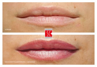 Vorher-Nachher-Ansicht eines Permanent Make-up der Lippen