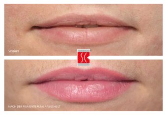 Vorher-Nachher-Ansicht eines Permanent Make-up der Lippen